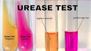 Urea Hydrolysis Urease Test [upl. by Yahsat]