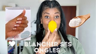 5 ASTUCES POUR BLANCHIR SES ONGLES [upl. by Karyl]