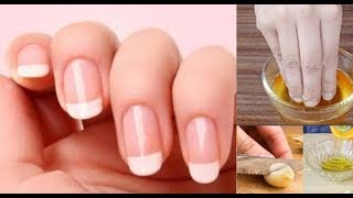 ASTUCE FAIRE POUSSER SES ONGLES PLUS VITE [upl. by Copland]