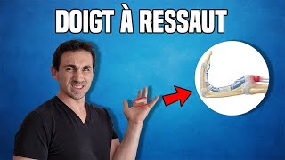 SOLUTIONS CONTRE LE DOIGT À RESSAUT  EXPLICATION ET EXERCICES KINÉ [upl. by Annohsed340]