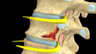 Noncontrast MRI cervical spine search pattern [upl. by Beverlie701]