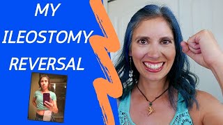 My Ileostomy Reversal Experience [upl. by Knutson295]