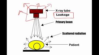 RADIATION PROTECTION  SIMPLIFIED for radiology residents [upl. by Norod324]