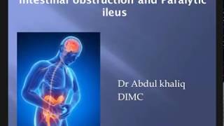 Intestinal Obstruction amp Paralytic Ileus  Surgery [upl. by Kevan]