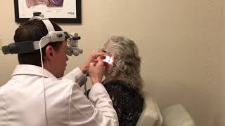 Micro Suction Cerumen Ear Wax Removal Procedure [upl. by Bozovich]